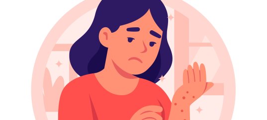 Тест по биологии: Заболевания кожи и их предупреждение (9 класс)