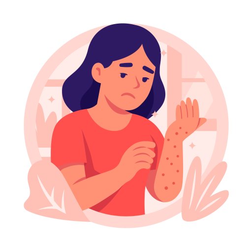 Тест по биологии: Заболевания кожи и их предупреждение (9 класс)